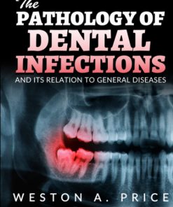 The Pathology of Dental infections And its relation to general diseases