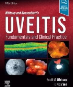 Whitcup and Nussenblatt's Uveitis Fundamentals and Clinical Practice 5th Edition