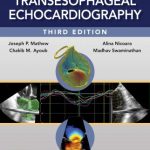 Clinical Manual and Review of Transesophageal Echocardiography 3rd Edition