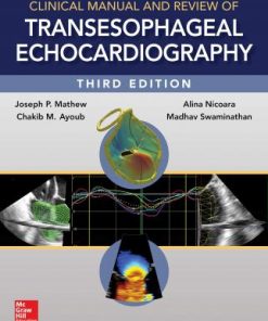 Clinical Manual and Review of Transesophageal Echocardiography 3rd Edition