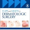 Flaps and Grafts in Dermatologic Surgery