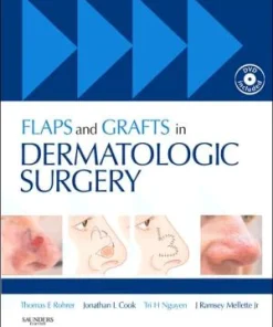 Flaps and Grafts in Dermatologic Surgery