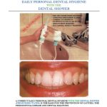 DAILY PERSONAL DENTAL HYGIENE WITH THE DENTAL SHOWER THE PERSONAL DENTAL SHOWER