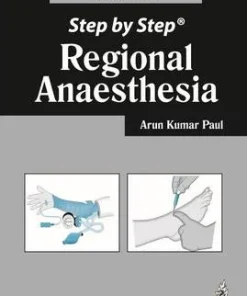 Step by Step Regional Anaesthesia 2nd Edition
