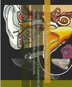 O uso do dispositivo auricular para o tratamento da disfunção temporomandibular e bruxismo