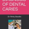 Diagnosis of Dental Caries