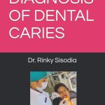 Diagnosis of Dental Caries