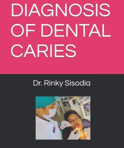 Diagnosis of Dental Caries