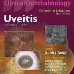 Color Atlas and Synopsis of Clinical Ophthalmology Uveitis 2nd Edition