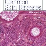 Common Skin Diseases 18th Edition