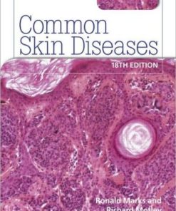 Common Skin Diseases 18th Edition