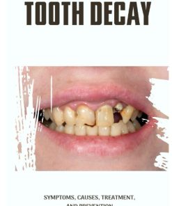 Tooth Decay Symptoms Causes Treatment and Prevention