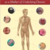 Hall's Manual of Skin As a Marker of Underlying Disease