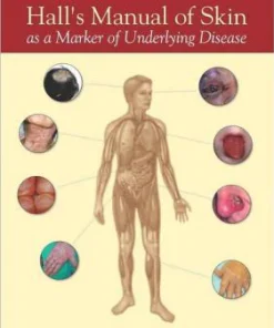Hall's Manual of Skin As a Marker of Underlying Disease