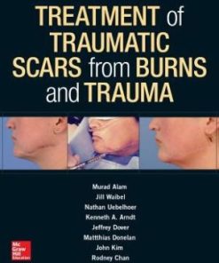 Treatment of Scars from Burns and Trauma