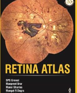 Retina Atlas