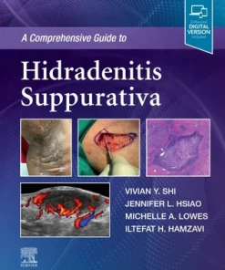 A Comprehensive Guide to Hidradenitis Suppurativa