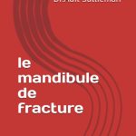 Le mandibule de fracture