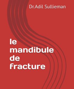 Le mandibule de fracture