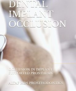 DENTAL IMPLANT OCCLUSION OCCLUSION IN IMPLANT SUPPORTED PROSTHESID