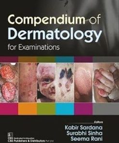Compendium of Dermatology for Examinations
