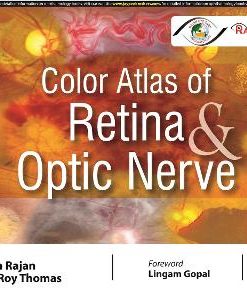 Color Atlas of Retina & Optic Nerve