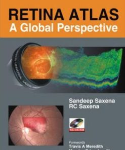 Retina Atlas A Global Perspective