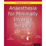 Anaesthesia for Minimally Invasive Surgery