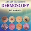 A PractA Practical Guide to Dermoscopyical Guide to Dermoscopy