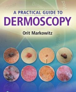 A PractA Practical Guide to Dermoscopyical Guide to Dermoscopy