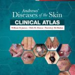 Andrews' Diseases of the Skin Clinical Atlas