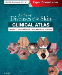 Andrews' Diseases of the Skin Clinical Atlas