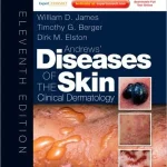 Andrews' Diseases of the Skin 11th Edition