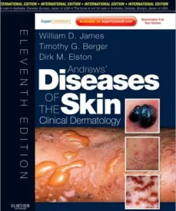 Andrews' Diseases of the Skin 11th Edition