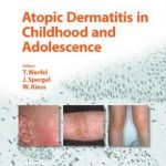 Atopic Dermatitis in Childhood and Adolescence
