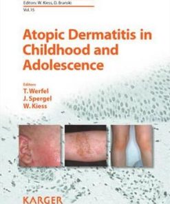 Atopic Dermatitis in Childhood and Adolescence