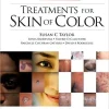 Treatments for Skin of Color