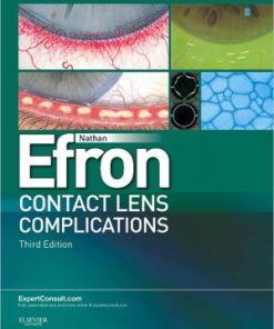 Contact Lens Complications 3rd Edition