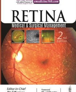 Retina Medical & Surgical Management 2nd Edition