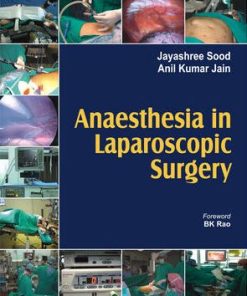 Anaesthesia in Laparoscopic Surgery