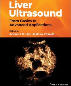 Liver Ultrasound From Basics to Advanced Applications 1st Edition