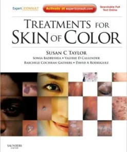 Treatments for Skin of Color
