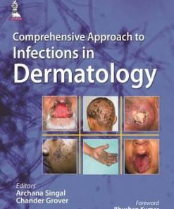 Comprehensive Approach to Infections in Dermatology