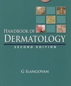 Handbook of Dermatology 2nd Edition