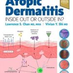 Atopic Dermatitis Inside Out Or Outside In