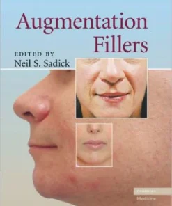 Augmentation Fillers
