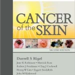 Cancer of the Skin 2nd Edition