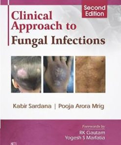 Clinical Approach to Fungal Infections 2nd Edition