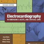 Electrocardiography in Emergency Acute and Critical Care
