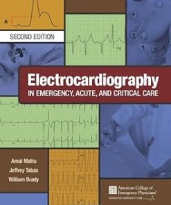 Electrocardiography in Emergency Acute and Critical Care
